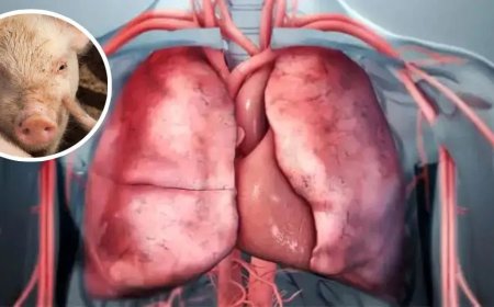 মানবদেহে শূকরের ফুসফুস প্রতিস্থাপন