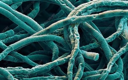 অ্যানথ্রাক্স যেভাবে মানুষের মধ্যে ছড়ায় 